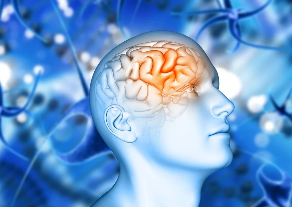 Neurological Disorders 1 image 38