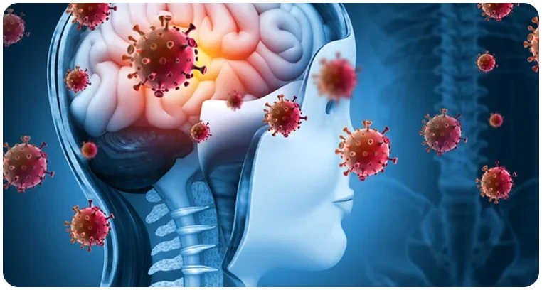 brain infection causing seizures