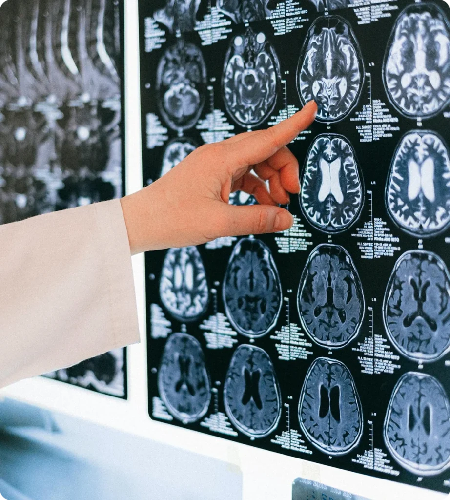 eurological treatment brain mri scan