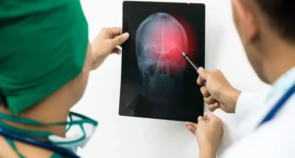 examining a skull X ray for seizure treatment delhi