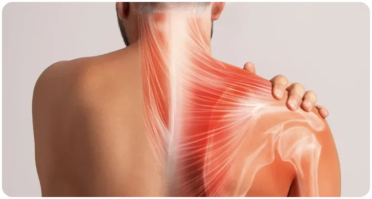 neck shoulder pain tension headache