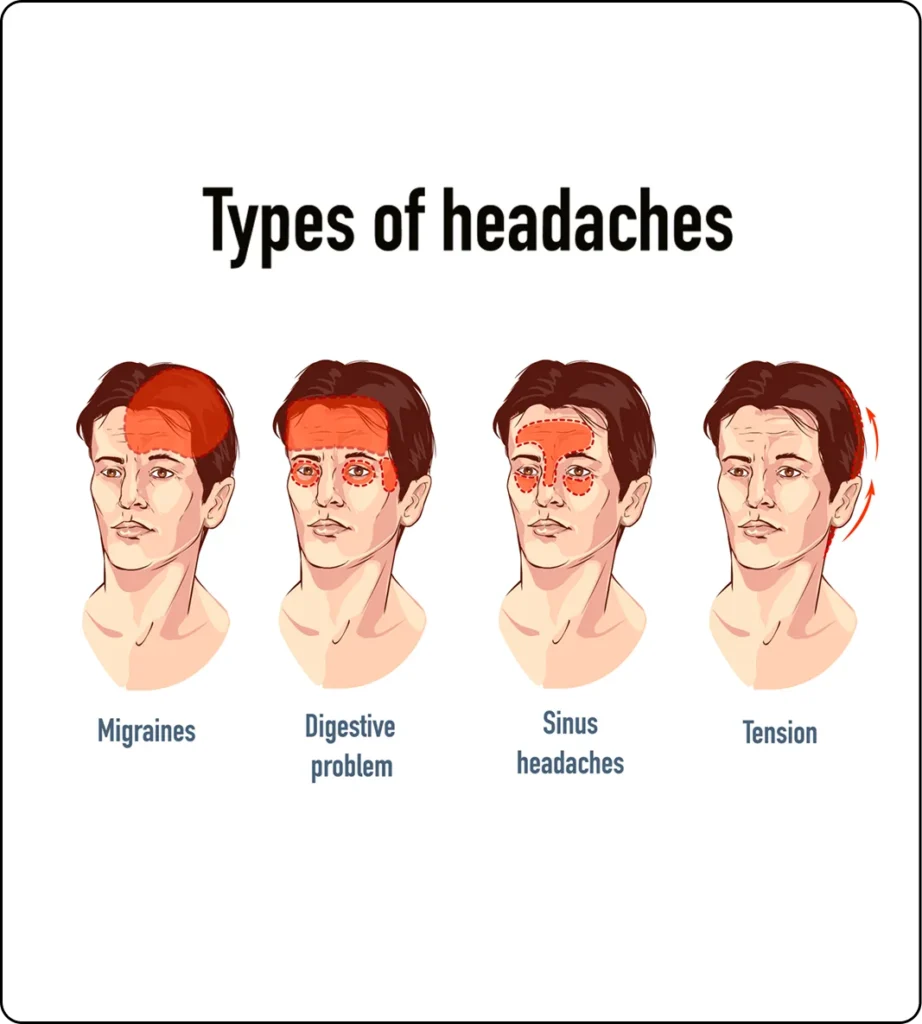 types of headaches migraine sinus tension